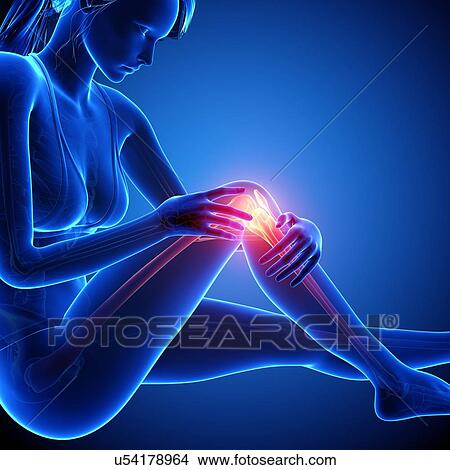 Knee pain, artwork View Large Illustration Stock Illustration - Knee pain, artwork. Fotosearch