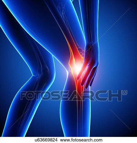 Knee pain, artwork View Large Illustration Stock Illustration - Knee pain, artwork. Fotosearch