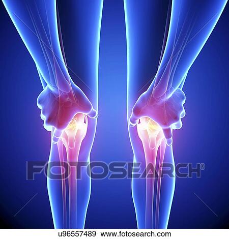 Knee pain, artwork View Large Illustration Stock Illustration - Knee pain, artwork. Fotosearch