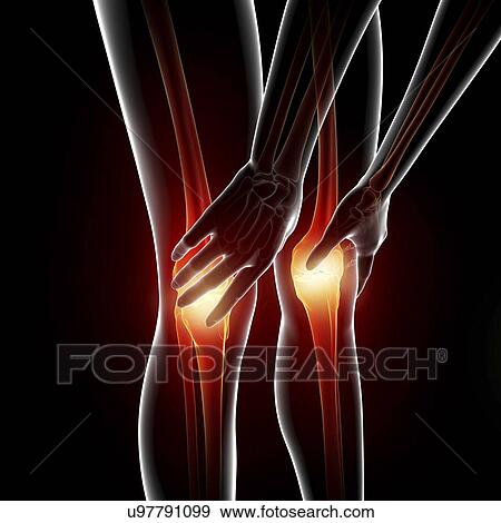 Stock Illustration - Knee pain, artwork. Fotosearch