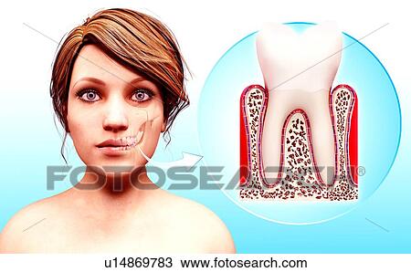 Molar tooth, artwork View Large Illustration Drawing - Molar tooth, artwork. Fotosearch