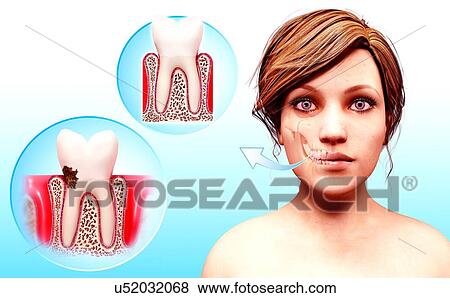 Molar tooth, artwork View Large Illustration Stock Illustration - Molar tooth, artwork. Fotosearch