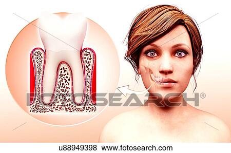 Stock Illustration - Molar tooth, artwork. Fotosearch