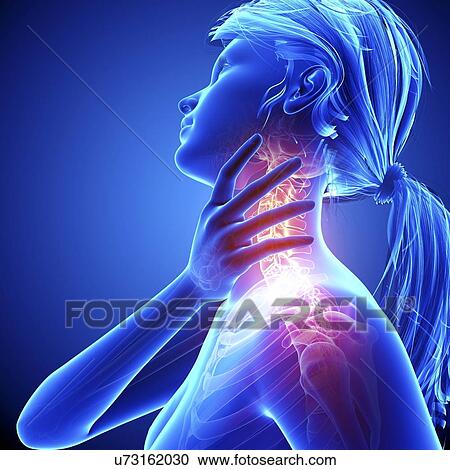 Neck pain, artwork View Large Illustration Clipart - Neck pain, artwork. Fotosearch
