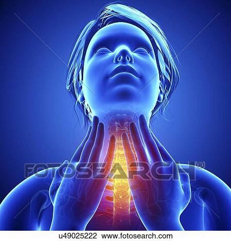 Neck pain, artwork View Large Illustration Drawing - Neck pain, artwork. Fotosearch