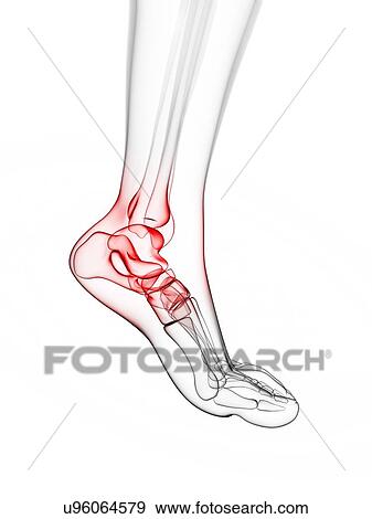 Painful ankle, artwork View Large Illustration Stock Illustration - Painful ankle, artwork. Fotosearch