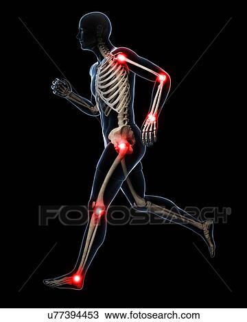 Painful joints, artwork View Large Illustration Drawing - Painful joints, artwork. Fotosearch