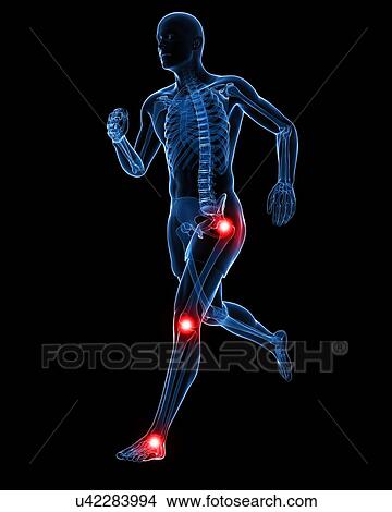 Painful joints, artwork View Large Illustration Stock Illustration - Painful joints, artwork. Fotosearch