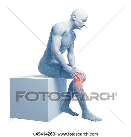 Painful knee, artwork View Large Illustration Drawing - Painful knee, artwork. Fotosearch