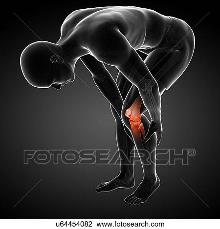 Painful knee, artwork View Large Illustration Drawing - Painful knee, artwork. Fotosearch