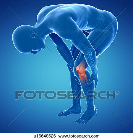 Painful knee, artwork View Large Illustration Stock Illustration - Painful knee, artwork. Fotosearch