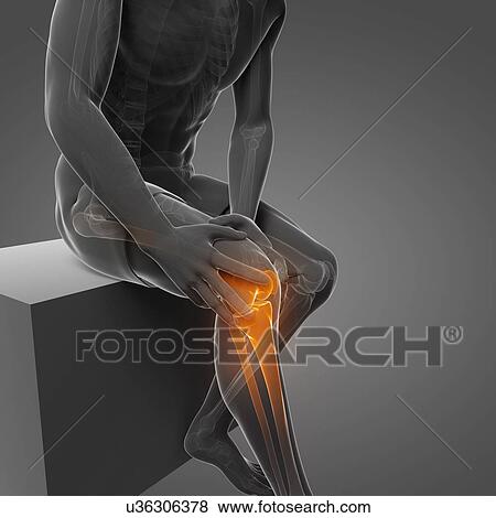 Stock Illustration - Painful knee, artwork. Fotosearch