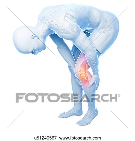 Stock Illustration - Painful knee, artwork. Fotosearch