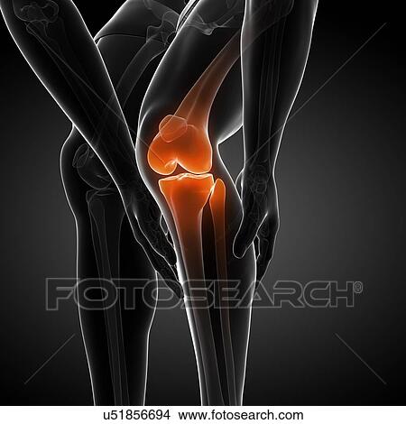 Stock Illustration - Painful knee, artwork. Fotosearch
