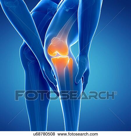 Stock Illustration - Painful knee, artwork. Fotosearch