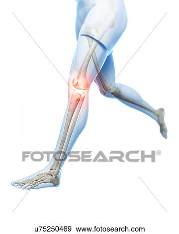 Stock Illustration - Painful knee, artwork. Fotosearch