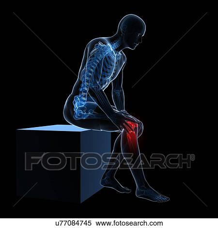 Stock Illustration - Painful knee, artwork. Fotosearch