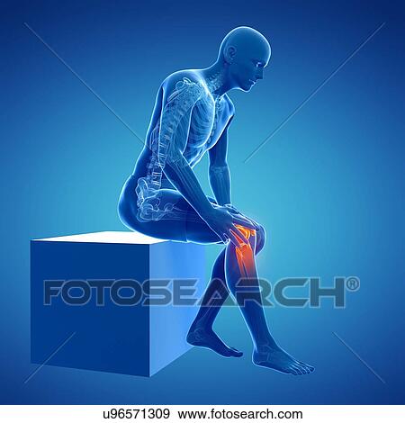 Stock Illustration - Painful knee, artwork. Fotosearch