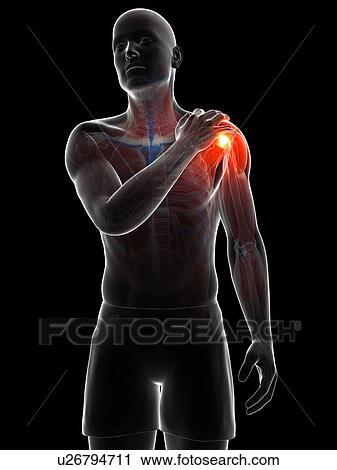 Painful shoulder, artwork View Large Illustration Clip Art - Painful shoulder, artwork. Fotosearch