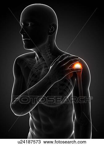 Painful shoulder, artwork View Large Illustration Drawing - Painful shoulder, artwork. Fotosearch