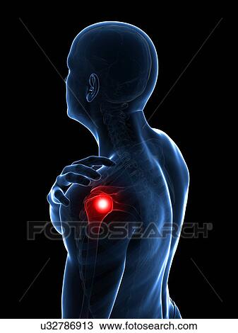Painful shoulder, artwork View Large Illustration Drawing - Painful shoulder, artwork. Fotosearch