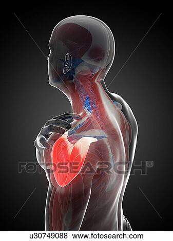 Painful shoulder, artwork View Large Illustration Stock Illustration - Painful shoulder, artwork. Fotosearch