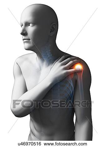 Painful shoulder, artwork View Large Illustration Stock Illustration - Painful shoulder, artwork. Fotosearch