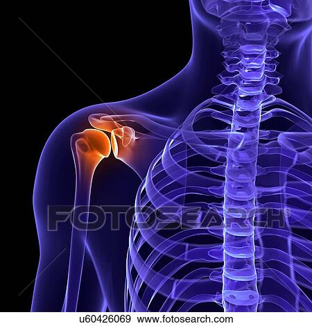 Painful shoulder, artwork View Large Illustration Stock Illustration - Painful shoulder, artwork. Fotosearch