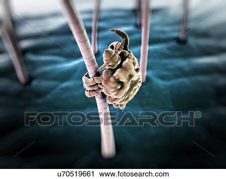 Clip Art - Pubic louse, artwork. Fotosearch