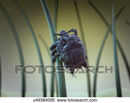 Pubic louse, artwork View Large Illustration Stock Illustration - Pubic louse, artwork. Fotosearch