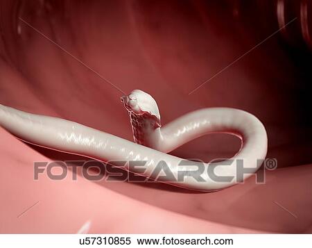 Round worm, artwork View Large Illustration Stock Illustration - Round worm, artwork. Fotosearch