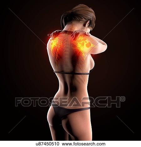 Shoulder pain, artwork View Large Illustration Clipart - Shoulder pain, artwork. Fotosearch