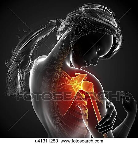 Shoulder pain, artwork Drawing | u41311253 | Fotosearch