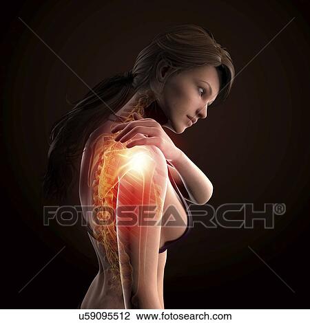 Shoulder pain, artwork View Large Illustration Drawing - Shoulder pain, artwork. Fotosearch