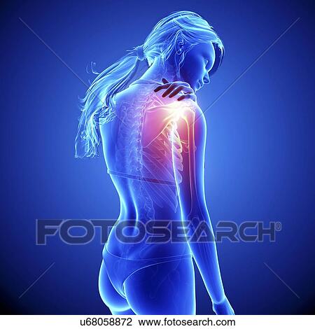 Shoulder pain, artwork Drawing | u68058872 | Fotosearch