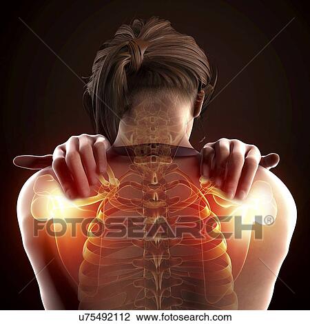 Shoulder pain, artwork View Large Illustration Drawing - Shoulder pain, artwork. Fotosearch