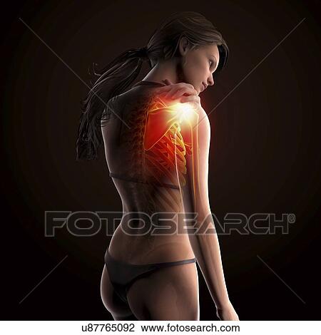 Shoulder pain, artwork View Large Illustration Drawing - Shoulder pain, artwork. Fotosearch