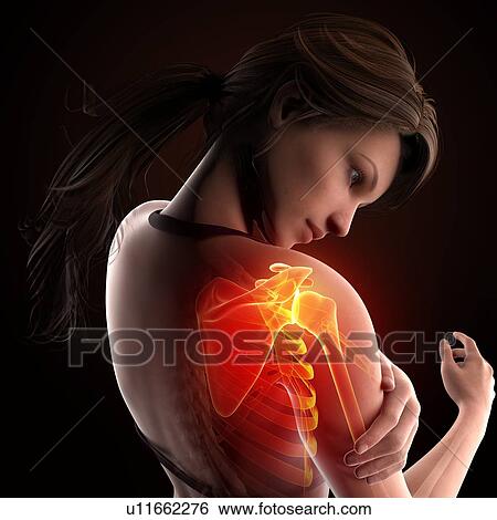 Shoulder pain, artwork View Large Illustration Stock Illustration - Shoulder pain, artwork. Fotosearch