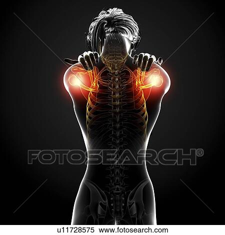 Shoulder pain, artwork View Large Illustration Stock Illustration - Shoulder pain, artwork. Fotosearch