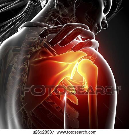 Shoulder pain, artwork View Large Illustration Stock Illustration - Shoulder pain, artwork. Fotosearch