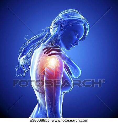 Shoulder pain, artwork View Large Illustration Stock Illustration - Shoulder pain, artwork. Fotosearch