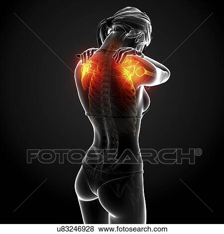 Shoulder pain, artwork View Large Illustration Stock Illustration - Shoulder pain, artwork. Fotosearch