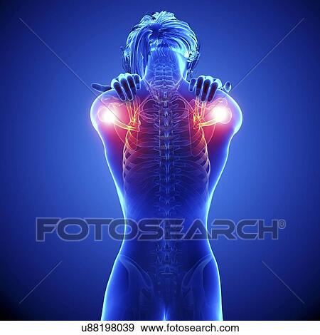Shoulder pain, artwork View Large Illustration Stock Illustration - Shoulder pain, artwork. Fotosearch