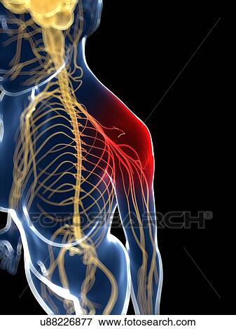 Stock Illustration - Shoulder pain, artwork. Fotosearch