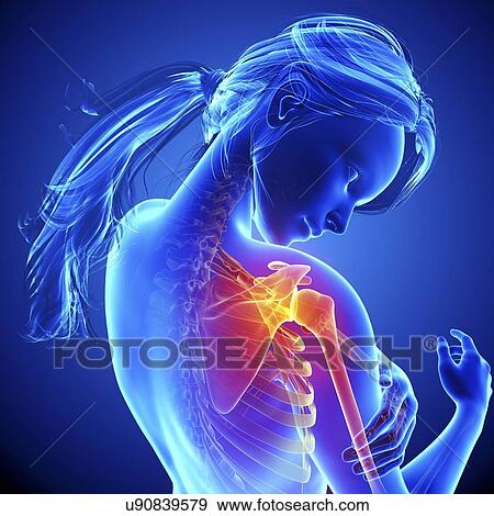 Shoulder pain, artwork View Large Illustration Stock Illustration - Shoulder pain, artwork. Fotosearch
