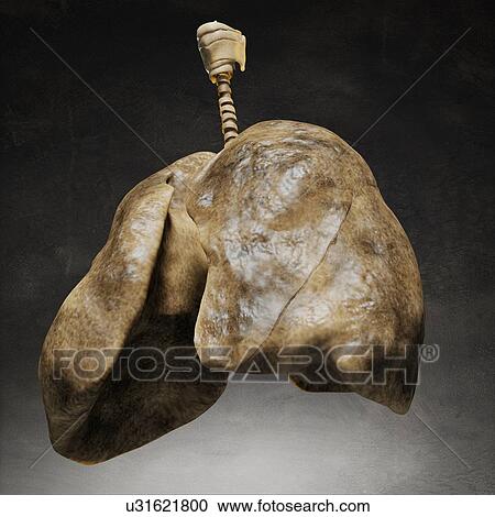 Smoker's lungs, artwork View Large Illustration Clipart - Smoker's lungs, artwork. Fotosearch