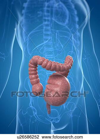 Drawing - Toxic megacolon, artwork. Fotosearch