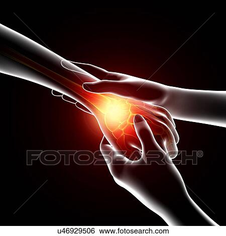 Stock Illustration - Wrist pain, artwork. Fotosearch