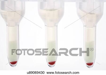 Blood group test View Large Illustration Clipart - Blood group test. Fotosearch