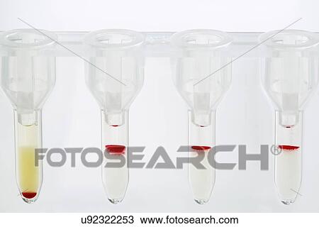 Drawing - Blood group test. Fotosearch